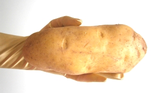 Rohe Kartoffel Giftig